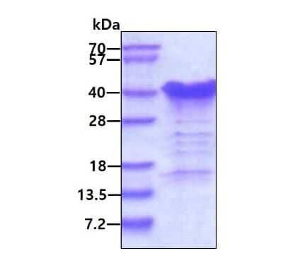 SDS-PAGE: Recombinant Human TCEAL3 His Protein [NBP1-98947]